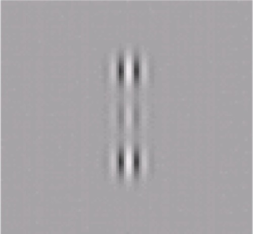 Figure 2 Lateral masking technique.