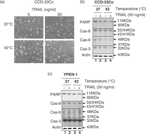 Figure 4. Effect of hyperthermia in combination with TRAIL on cell morphology, proteolytic cleavage of PARP and activation of caspases in normal cell lines CCD-33Co and YPEN-1. (a) CCD-33Co cells were heated at 42°C for 4 h in the presence or absence of 50 ng ml−1 TRAIL. The morphological features were analysed with a phase-contrast microscope. (b, c) CCD-33Co cells or YPEN-1 cells were heated at 42°C for 4 h in the presence or absence of 50 ng ml−1 TRAIL. Cell lysates were subjected to immunoblotting for PARP and caspases as described in Figure 1.
