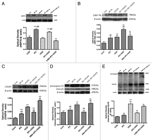 Figure 3. 3-MA decreased HSP70 and GRP78 expression, while increasing CHOP, cleaved caspase-12 and caspase-3 expression in cortical neurons. Cortical neurons were treated as described in the legend to Figure 2. The protein levels of HSP70, GRP78, CHOP, caspase-12 and caspase-3 were detected with immunoblotting. Levels of β-actin protein were used as the loading control. Quantitative analysis was performed with Sigma Scan Pro 5. (A): Protein expression of HSP70. (B) Protein expression of GRP78. (C) Protein expression of CHOP. (D) Protein expression of caspase-12. (E) Protein expression of caspase-3. Bar represents mean ± SD, n = 6. *p < 0.05, **p < 0.01 compared with the control group; #p < 0.05, ##p < 0.01 compared with the OGD group; $p < 0.05, $$p < 0.01 compared with IPC+OGD group.