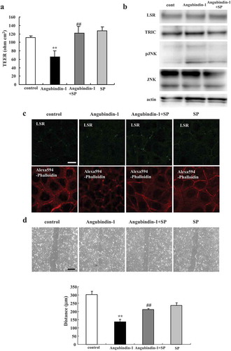Figure 5. JNK inhibitor SP600125 prevents effects of angubindin-1 in Sawano cells (a) Bar graph of TEER values representing barrier function of Sawano cells pretreated with 10 μM JNK inhibitor SP600125 with or without 2.5 μg/ml angubindin-1. **p < .01, vs control. ##p < .01, vs angubindin-1. (b) Western blot analysis for LSR, TRIC, pJNK and JNK in Sawano cells pretreated with 10 μM SP600125 with or without 2.5 μg/ml angubindin-1. (c) Immunocytochemical analysis for LSR (green) and F-actin (Alexa 594-Phalloidin, red) in Sawano cells treated with 10 μM SP600125 with or without 2.5 μg/ml angubindin-1. Bar: 5 μm. (d) Migration assay of Sawano cells pretreated with 10 μM SP600125 with or without 2.5 μg/ml angubindin-1. Bars: 100 μm. **p < .01, vs control. ##p < .01, vs angubindin-1.