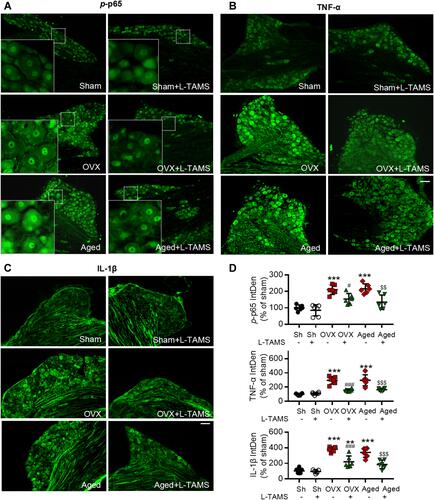 Figure 4 Oral application of L-TAMS attenuates the activation of NF-κB and upregulation of TNF-α and IL-1β in dorsal root ganglion (DRG) neurons of ovariectomized and aged mice. (A–C) Representative immunofluorescent staining images show the expressions of p-p65 (A), TNF-α (B) and IL-1β (C) in DRG neurons in indicated groups.