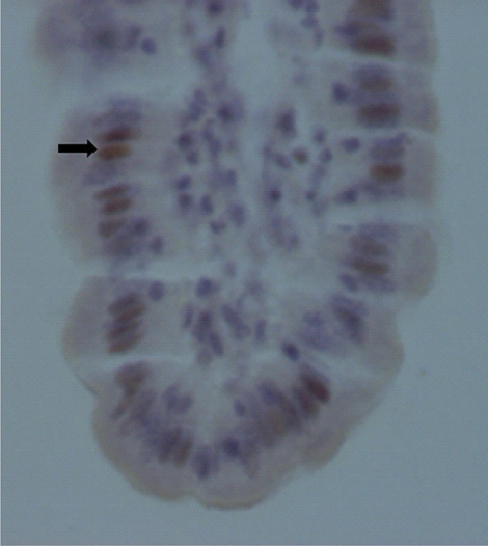 Figure 1.  Apoptotic cells (arrows) in the villus of mid-jejunum in piglets fed with soybean antigens (TUNEL, original magnification×800).