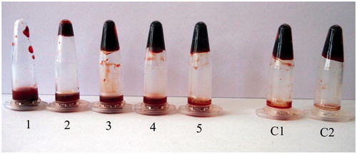 Figure 8. In vitro thrombolytic activity of xylarinase. The degradation of thrombus was observed by immersing the clot in various concentrations of xylarinase for 60 min. 1: 50 μg, 2: 40 μg, 3: 30 μg, 4: 20 μg, 5: 10 μg. C1 and C2: Control.