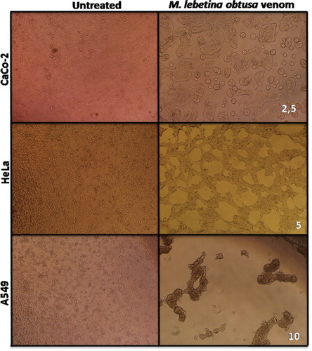Figure 3. Macrovipera lebetina obtusa venom-induced morphological changes in A549, HeLa and CaCo-2 cells viewed by an inverted microscope. Cells were exposed to crude venom for 48 h. Numbers on the lower right corner of microphotographs indicate the concentration of venom used (µg/ml).