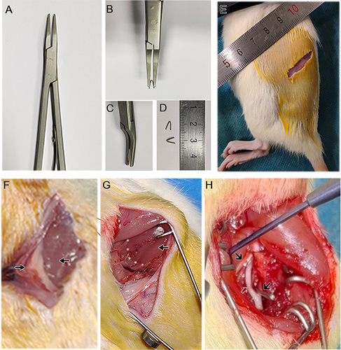 Figure 1 Construction of a new L5 spinal nerve ligation model by oblique lateral approach. (A–D) Homemade U-shaped titanium wire clip and matching titanium clamp. (E) Location and size of the surgical opening. (F) Peritoneum and quadratus lumborum. Display full size: Quadratus lumborum; Display full size: extraperitoneal adipose tissue. (G) The muscle space between the quadratus lumborum and the iliopsoas. Display full size: Quadratus lumborum; White dotted line: intermuscular space. (H) Diagram illustrating the positional connections of L3, L4, and L5 spinal nerves, and ligation of the L5 spinal nerve using titanium clips. Display full size: L3 spinal nerve; Display full size: L4 spinal nerve; Display full size: L5 spinal nerve and titanium clamp ligation location.