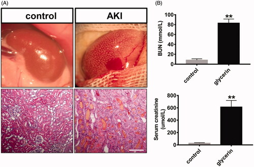 Figure 1. AKI rats model were induced by intramuscular injection of glycerol. Twenty-four hours after glycerol injection, the release of a large amount of myoglobin resulted in acute kidney injury, and the kidney was enlarged and textured (A). The levels of serum creatinine and urea nitrogen in the AKI group were significantly higher than the normal control group (B). Bar: 100 μm.