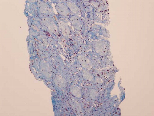 Figure 5. HH trichrome of glomerular cortex 10×.