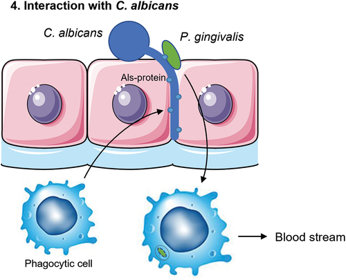 Figure 4. Schematic overview of the fourth mechanism of translocation. C. albicans can form invasive hyphae that insert themselves between the epithelial cells. P. gingivalis can adhere to C. albicans via the Als3 protein on the hyphae of the fungi. Phagocytic cells such as macrophages are attracted to C. albicans. This allows for the phagocytes to come in close contact to the bacterium and take up P. gingivalis to travel back into the blood stream.