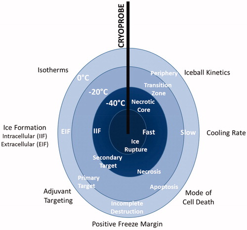 Figure 3. A schematic representation of the dynamics and events of the freeze zone.