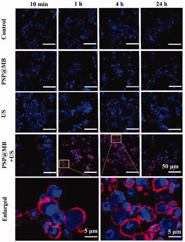 Figure 5. Enhancing endocytosis of gene by ultrasound and PSP@MB. Ultrasound combined with PSP@MB to promote OCSCs endocytosis of CY5-pDNA. There were four groups: Control group, PSP@MB group, US group, and US + PSP@MB group. US + PSP@MB group for 1 h and 4 h was enlarged. CLSM images of OCSCs transfected with PSP@MB combined ultrasound for 10 min, 1 h, 4 h, and 24 h. There were more CY5-pDNA (red) in OCSCs in the PSP@MB + US group compared to PSP@MB group or P(CY5-pDNA) group. It showed that PSP@MB + US could efficiently deliver pDNA to OCSCs with enhancing endocytosis. The time of higher intracellular pDNA was 1–4 h.