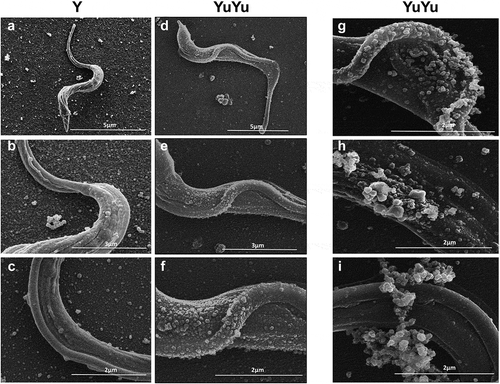 Figure 2. SEM of T. cruzi trypomastigotes from Y and YuYu strains showing shedding of EVs. Each panel shows trypomastigotes pre-incubated in DMEM with 2% glucose and attached to glass coverslips containing poly-lysine obtained from the Y (a) and YuYu strains (b), fixed and processed for SEM. The bar sizes are indicated in each image.