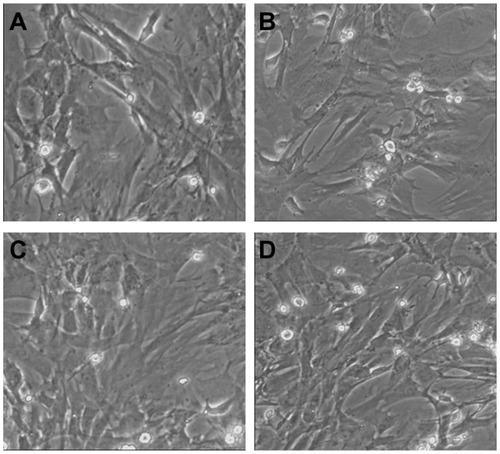 Figure 9 Transmission electron microscopy (TEM) images of MSCs before and after transfection. (A) TEM image of mesenchymal stem cells before transfection; (B–D) TEM images of mesenchymal stem cells after transfection by CPEPS-pTGF- β1 nanoparticles with CPEPS/pTGF-β1 weight ratios of 10:1, 20:1, and 30:1, respectively.Abbreviations: CPEPS, cationized Pleurotus eryngii polysaccharide; pTGF-β1, plasmid encoding transforming growth factor beta-1.