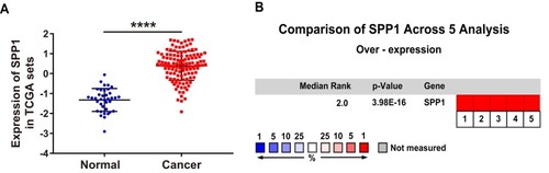 Figure 1 Elevated expression of the OPN gene in human NSCLC tissues. (A) Relative expression of OPN mRNA in 125 human NSCLC tissues and 37 normal tissues based on TCGA data. (B) Heatmap of OPN (also known as SPP1) gene expression in clinical NSCLC samples and normal tissues based on Oncomine data. ****P<0.0001. (1. Lung Adenocarcinoma vs Normal Bhattacharjee Lung, Proc Natl Acad Sci USA, 2001;Citation21 2. Lung Adenocarcinoma vs Normal Hou Lung, PLoS One, 2010;Citation22 3. Lung Adenocarcinoma vs Normal Landi Lung, PLoS One, 2008;Citation23 4. Lung Adenocarcinoma vs Normal Selamat Lung, Genome Res, 2012;Citation24 5. Lung Adenocarcinoma vs Normal Su Lung, BMC Genomics, 2007.Citation25)