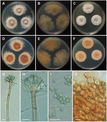 Figure 6. Morphology of Aspergillus spinulosporus CNUFC CY2264. (A, D) Colonies on Czapek yeast autolysate agar (CYA); (B, E) malt extract agar (MEA); (C, F) yeast extract sucrose agar (YES) (A–C: obverse view and D–F: reverse view); (G, H) Conidiophores; (I) Conidia; (J) Hülle cells. Scale bars: G–I = 10 µm, J = 20 µm.