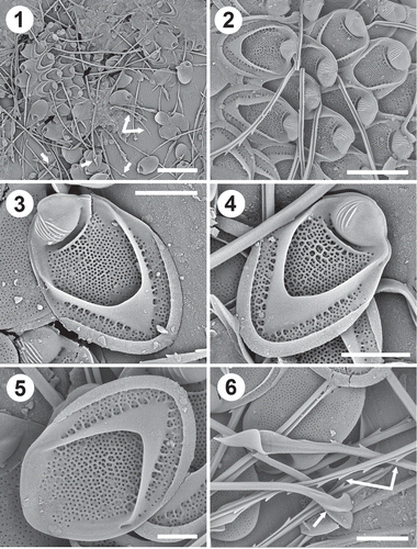 Figs 1–6. Scale and bristle remains from a population of Mallomonas intermedia cells from Dufurrena Pond 19, northern Nevada, USA. Fig. 1. Remains of domed and domeless scales (black arrows), short serrated bristles (double white arrows), and long bristles with lance-shaped apices (single white arrows). Fig. 2. A group of domed body scales. Note the single large transverse rib immediately behind the dome, secondary reticulation on the shield and posterior flange and ribs on the dome. Figs 3–4. Domed body scales denoting the tripartite design, the single transverse rib behind the dome and the ribs originating along the V-rib and extending onto the posterior flange. The scale in Fig. 3 had more ribs on the dome, but less reticulation on the shield than the scale in Fig. 4. Fig. 5. Domeless body scale. Fig. 6. Undersurface of a domed body scale showing the pattern of base plate pores, and close-ups of bristles denoting the lance apex, foot (white arrow) and serration on the shaft (double white arrow). Scale bars = 1 µm (Fig. 5), 2 µm (Figs 3, 4, 6), 4 µm (Fig. 2) and 10 µm (Fig. 1).