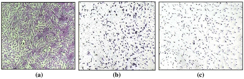 Figure 9. Morphological and cytological features of breast cancer cell line (MCF7) (A–C) treated with Dimethyl formamide solution (vehicle control) (A), treated with sample PSFH3 in a concentration of 2 mg/mL (B), and treated with sample PSFB3 in a concentration of 2 mg/ml (C) after 72 h of cell exposure to the investigated samples.