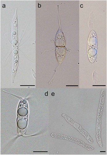 Figure 3. (A) Corollospora quinqueseptata, (B) Corollospora gracilis, (C) Remispora hamata, (D) Arenariomyces trifurcatus, and (E) Setoseptoria phragmitis. Scale bars: A = 30 µm, B–E = 10 µm.