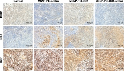 Figure 6 Immunohistochemical staining of MDR1, Bcl-2, and Ki67; ×200.Abbreviations: DOX, doxorubicin; MDR, multidrug resistance; MSNP, mesoporous silica nanoparticles; PEI, polymerpolyethylenimine.