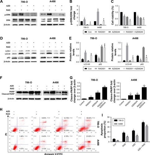 Figure 3 Selumetinib (AZD6244) significantly enhances RAD001-induced apoptosis of RCCs.