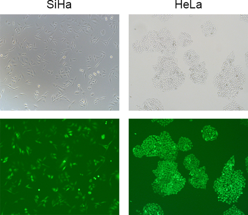 Figure S2 Transfection efficiency in SiHa and HeLa cells.Notes: Stable PKM2 knockdown cells were screened after incubation with 8 μg/mL of puromycin for 48 hours. Green fluorescence protein was detected using a Nikon Eclipse fluorescent microscope.Abbreviation: PKM2, pyruvate kinase isozyme type M2.
