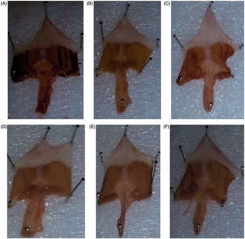 Figure 3. (A) Treatment with 80% ethanol only, showing mucosal ulceration. (B) Treatment with ranitidine (50 mg/kg) showing normal mucosa. (C) Treatment with compound 3 (50 mg/kg) showing intact mucosa with mild ulceration. (D) Treatment with compound 8 (50 mg/kg) showing intact normal mucosa. (E) Treatment with compound 11 (50 mg/kg) showing intact normal mucosa. (F) Treatment with compound 15 (50 mg/kg) showing intact normal mucosa.