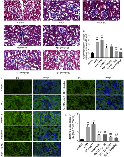 Figure 4. Effect of Rg1 treatment on renal fibrosis in T2DM mice. (A) The results of fibrosis in the renal cortex (Masson staining, ×400). (B) The mean density of Masson staining in the renal cortex. (C) The result of FN expression in the renal cortex (immunofluorescence, ×400). (D) The mean density of FN fluorescence in the renal cortex. The data are expressed as the mean ± SD, Masson, n = 6, FN, n = 4, **p< 0.01 compared with the control group; #p< 0.05, ##p< 0.01 compared with the HFD + STZ group.