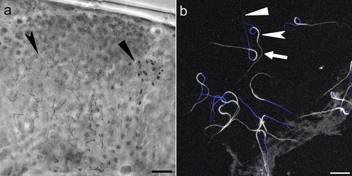 Figure 7. Mesobiotus huecoensis sp. nov. male gonad and spermatozoa. (a) Male gonad under PCM stained with orcein showing different maturation stages of the male gamets. (b) Stained spermatozoa under Confocal Microscopy, blue represents stained DNA (nucleus), whereas white represents Phalloidin-stained actin (acrosome, midpiece, tail). Black arrowhead: spermatids. Black indented arrowhead: mature spermatozoa. White arrowhead: acrosome. White indented arrowhead: midpiece. White arrow: tail. Scalebars:10 µm.