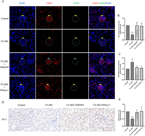 Figure 7 Reduction of NETs levels alleviates endothelial cell injury in glomeruli and PTC. (A–C) IF co-staining and semi-quantitative analysis of CD31 and CitH3 in mouse kidney sections (n=6). Magnification 630×. (D and E) Immunohistochemical staining and semi-quantitative analysis of PV-1 in mouse kidney sections (n=6). Magnification 1300×. * VS control group, **P < 0.01, ****P < 0.0001, indicating statistically significant data between groups; # VS CI-AKI group, #P < 0.05, ##P < 0.01, ###P < 0.001, indicating statistically significant data between groups.