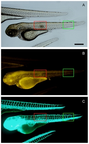 Figure 5 In vivo angiogenesis targeting of Rh-SWCNT-RGD in zebrafish wound healing model. By imaging transgenic fli1a:EGFP zebrafish that contained fluorescently-labeled endothelial cells, angiogenesis associated with wound healing in transgenic zebrafish embryos can be observed by checking the GFP signal. (A) Bright view and (B) Rh channel. Red fluorescence indicates the location of Rh-SWCNT-RGD in the zebrafish embryos. (C) indicates the FITC channel. Green fluorescence indicates distribution of fluorescently-labeled endothelial cells in transgenic zebrafish embryos. The red boxed area marks the region with a wound. The green boxed area marks a normal region in the zebrafish trunk. Scale bar: 150 μm.Abbreviations: RGD, cyclic arginine-glycine-aspartic peptide; SWCNT, single-walled carbon nanotubes; Rh, rhodamine; FITC, fluorescein isothiocyanate; EGFP, enhanced green fluorescent protein.