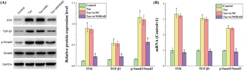 Figure 6. The results for the protein and RNA expression levels of the TGF-β1/Smad3 pathway in each group of kidney tissues. (A) The results for the protein expression levels detected by western blot. (B) The results for the RNA expression levels detected by RT-qPCR. *p < 0.05, compared to the Control group. #p < 0.05, compared to the Tac and Tac + si-NC groups.