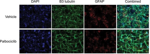 Figure 8 Treatment of rat hippocampal primary cultures with palbociclib did not elicit cytotoxicity.Notes: Primary hippocampal culture treated with vehicle solution or 2 µM palbociclib for 24 hours. Intact neuronal networks and normal glial cell morphology was observed in cultures treated with palbociclib, suggesting no significant toxicity. Cell nuclei were stained with DAPI (blue); neurons were stained with B3 tubulin antibody (green); glial cells were stained with the GFAP antibody (red/orange).Abbreviations: DAPI, 4′,6-diamidino-2-phenylindole; B3 tubulin, tubulin, beta III isoform; GFAP, glial fibrillary acidic protein.