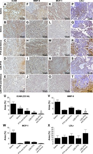 Figure 3 Immunohistochemical study of tumors from melanoma-bearing mice.Notes: Mice treated with PTX oleate 17.5 μmol/kg associated with LDE + Simva 50 mg/kg; PTX oleate 17.5 μmol/kg associated with LDE; commercial formulation of PTX 17.5 μmol/kg + Simva 50 mg/kg; Simva 50 mg/kg; and saline solution 0.9% as control. Animals were intraperitoneally injected with chemotherapy on days 11, 14, and 19. Simva was administered daily by gavage from day 11 to day 19. Each group comprised six animals. Representative photomicrographs from tumors (magnification 200×) after 3,3′-diaminobenzidine chromogen immunostaining for ICAM/CD54 (A–E), MMP-9 (F–J), MCP-1 (K–O), and LDLr (P–T). A quantitative image analysis of the immunostaining for ICAM/CD54 (U), MMP-9 (V), MCP-1 (W), and LDLr (X) was performed, and results are presented as means ± standard error of mean: •••vs saline (P<0.001); •vs saline (P<0.05); Θvs Simva (P<0.05); αvs LDE-PTX (P<0.05); +++vs all groups (P<0.001); ###vs PTX and Simva (P<0.001).Abbreviations: ICAM-1, intercellular adhesion molecule-1; LDE, lipid nanoemulsion; LDLr, low-density lipoprotein receptor; MCP-1, monocyte chemoattractant protein-1; MMP-9, matrix metalloproteinase-9; PTX, paclitaxel; Simva, simvastatin.