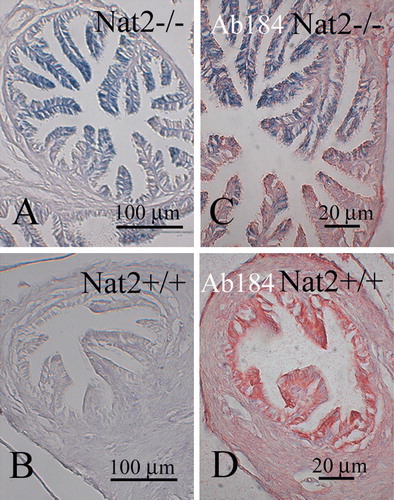 Figure 5.  Nat2 expression in oviduct epithelia. Transverse sections through bluo-gal stained oviducts of adult female Nat2−/ −  and Nat2+/ +  mice, analyzed for Nat2 expression and Nat2 protein; blue stain indicates Nat2 expression, detectable in Nat2−/ −  tissues (A and C), red stain indicates Nat2 protein in Nat2+/ +  tissues (D). (A and C) Sections through bluo-gal stained oviduct isolated from Nat2−/ −  mice. (B and D) Sections through bluo-gal stained control Nat2+/ +  mice. (C and D) After x-gal staining, sectioning and dewaxing, sections were probed with polyclonal anti-Nat2 antibody 184, visualized with alkaline phosphatase-conjugated fast red, to confirm the presence of Nat2 in Nat2+/ +  tissues. Scale bars: (A, B) 20 µm; (C, D) 100 µm. Colour available online.