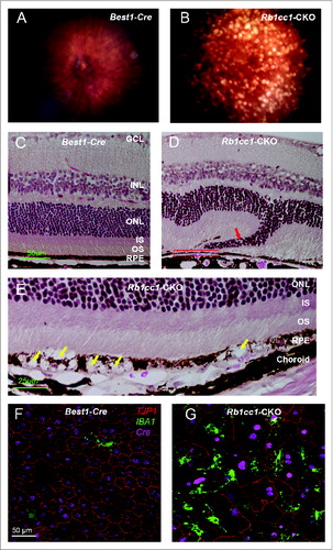 Figure 5. Inability to activate autophagy results in continued age-dependent degeneration of the RPE. (A, B) Fundus photograph of retina from 8-mo-old Rb1cc1-CKO mouse shows significant RPE degeneration. (C–E) Photomicrographs show the vacuolization of the RPE (yellow arrows), and areas of atrophy. Note the disruption of the outer nuclear layer of the retina (red arrow) where the RPE is absent (rectangle). (F, G) Flat mounts stained for the tight junction protein TJP1/ZO-1 show marked disruption of the normal hexagonal pattern of the RPE, and increased staining of IBA1-positive cells, consistent with increased infiltration of activated microglia. GCL, ganglion cell layer; INL, inner nuclear layer; IS, inner segment; ONL, outer nuclear layer; OS, outer segment; RPE, retinal pigment epithelium.