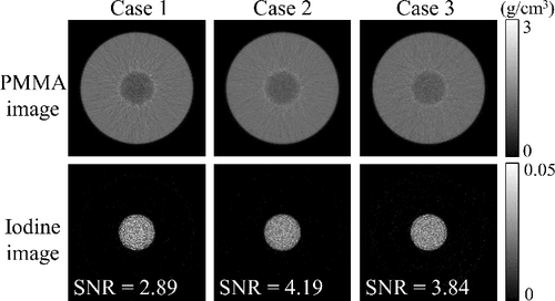 Figure 10. Images reconstructed from the material decomposition results. Upper row: PMMA density images. Bottom row: iodine density images. The SNR values were calculated from a 0.76-mm-diameter ROI inside each iodine region. The unit of image values is g/cm3 because the images are reconstructed tomographic images instead of projection data (cf. the unit in Figure 4).