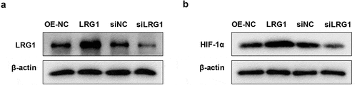 Figure 5. Effect of LRG1 on HIF-1α in normoxia H9c2. (a) Western blot was applied to detect the effect of LRG1 overexpression plasmid and siLRG1; (b) Western blot was used to detect HIF-1α protein expression