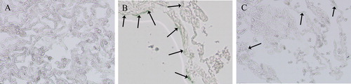 Figure 6. SA-β-gal activity of lung tissues from control group (A), emphysema group (B), and emphysema + SRT2104 group (C). The cells in lung samples with blue color were considered SA-β-gal positive, which means senescent cells. The arrows indicate the SA-β-gal-positive cells. Magnification, ×200.