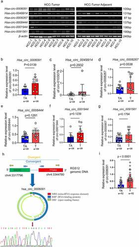 Figure 2. Hsa_circ_0006091 was considerably upregulated in HCC tissues. (a) The RT-PCR was employed to evaluate the expression of four candidate genes (hsa_circ_0006091, hsa_circ_0008444, hsa_circ_0049914, hsa_circ_0091561) in HCC tumor tissues (n = 10) and matched adjacent normal tissues (n = 10). Each band indicates a diverse patient sample. (b-e) hsa_circ_0006091, hsa_circ_0008444, hsa_circ_0049914 and hsa_circ_0091561 levels were determined through q-PCR in HCC tissues (n = 10) compared with paratumor tissue samples (n = 10), respectively. (f) The schematic diagram displaying that hsa_circ_0006091 was derived from RGS12. The head-to-tail splicing junction sequence was identified via the Sanger sequence. The structural diagram of hsa_circ_0006091 is from CSCD. T, tumor. TA, tumor adjacent tissue. (i) Further verification of hsa_circ_0006091 in 52 pairs of HCC and adjacent tissues.