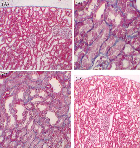 Figure 3.  (A) No fibrosis in control group, staining with Masson’s trichrome 100×. (B) Mild fibrosis in interstitium, staining with Masson’s trichrome 400× (GEN-treated group). (C) Mild fibrosis in interstitium, staining with Masson’s trichrome 200× (GEN + vehicle treated group). (D) No fibrosis in GEN + MK treated group, staining with Masson’s trichrome 100×.