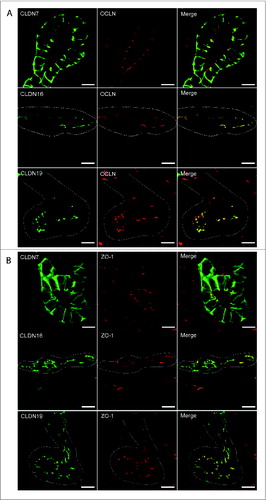 Figure 6. Claudin-7, 16, and -19 Co-Localize with Tight Junction Markers. Immunofluorescence was performed on cryosections taken from mouse P1 kidneys using antibodies to Claudin-7, -16, and -19 and co-localization was performed using antibodies to 2 tight junction markers, Occludin (A), and ZO-1 (B). Claudin-7 is expressed apically and basolaterally in ureteric bud tubules and is co-expressed with both ZO-1 and Occludin. Claudin-16 is expressed apically in Loop of Henle tubules and is co-expressed with ZO-1 and Occludin. Claudin-19 is expressed apically in Loop of Henle tubules and is co-expressed with ZO-1 and Occludin. Dotted white lines outline tubule segments. Scale bar = 10 μm.