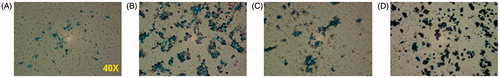 Figure 3. Prussian blue stained slides of nanoparticle loaded DU-145 cells. Images were obtained after 24 h incubation with (A) D-SPIO, (B) JHU, (C) Feridex, and (D) BNF.