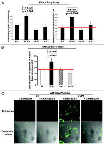 Figure 4. Expression of UCP1, but not UCP2 or UCP3, induces a catabolic stroma, with increased generation of ketone bodies, fatty acids and ATP-rich vesicles. (A) β-Hydroxybutyrate assay. Empty-vector (EV), UCP1, UCP2, or UCP3 fibroblasts were grown in phenol red-free DMEM, containing 2% FBS. After 48h, the concentration of β-Hydroxybutyrate was measured in the cell culture media and was normalized for protein concentration (left) or cell number (right). Note that fibroblasts overexpressing UCP1 display an up to 1.9-fold increase in β-Hydroxybutyrate accumulation, relative to control fibroblasts. Conversely, UCP2 and UCP3 fibroblasts show similar levels of β-Hydroxybutyrate production, as control cells. P values are as shown. (B) Fatty acid β-oxidation, using [3H]-palmitic acid as a substrate. Empty-vector (EV), UCP1, UCP2, or UCP3 fibroblasts were grown for 48h in complete media. Six replicates were performed for each condition. Results are expressed as mean ± SD (p = 0.0007 for UCP1 fibroblasts vs. empty-vector control fibroblasts). Note that UCP1, but not UCP2 or UCP3, promotes a 1.5-fold increase in the rate of fatty acid β-oxidation in human fibroblasts. (C) Quinacrine staining of ATP-□lled vesicles. Empty-vector or UCP1 fibroblasts were stained with quinacrine and immediately observed under the microscope. Where indicated, prior to quinacrine incubation, cells were treated with 25 µM chloroquine for 24 h. The Upper panels shows quinacrine staining (green). Lower panel show the overlay of quinacrine-staining and phase-contrast. Original magnification, 40x. The fluorescence staining indicates that ATP is mainly distributed in granular vesicles. The high 〉uorescence distributed within the cytoplasm demonstrates that UCP1 overexpression increases vesicular intracellular stores of ATP. The levels of green 〉uorescence (ATP accumulation) were dramatically decreased, following treatment with chloroquine.