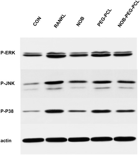 Figure 6 Cytokine- and serum-starved BMM were exposed to RANKL (100 ng/mL). Phosphorylated forms of p38, ERK, JNK, and β-actin were detected by Western blots.