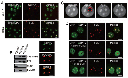 Figure 1. TP53INP2 is localized dynamically to the nucleolus through its C-terminal domain. (A) Colocalization of TP53INP2 with the nucleolar markers. The cells stained with anti-TP53INP2 and anti-POLR1A or anti-TP53INP2 and anti-FBL antibodies, were visualized by confocal microscopy. (B) Analysis of TP53INP2 distribution in subcellular fractions and purified nucleoli of HeLa cells. TUBB, LMNB1 or FBL was used as indicator of the cytosolic, nuclear or nucleolar fraction respectively. (C) HeLa cells transiently expressing GFP-TP53INP2 were imaged before and after photobleaching the indicated nucleolar region (red circle). (D) MCF-7 cells transiently expressing GFP-TP53INP2, GFP-TP53INP2Δ (191 to 212) or GFP-TP53INP2 (191 to 212) were stained with anti-FBL. Scale bars: 10 μm.