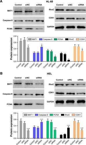 Figure 4 Effect of PDIA3 siRNA on expressions of PCNA, CDK1, MAT1, RhoC, and caspase-9.