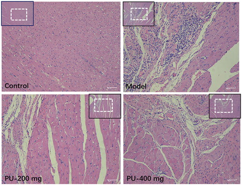 Figure 3. Punicalagin improved the morphological changes via HE staining (×100 and ×200).