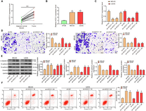 Figure 1 LncRNA HCG11 is highly expressed in OS with tumor-promoting effects. (A) the expression of lncRNA HCG11 in 20 OS and adjacent normal tissues (paired t-test, **p < 0.01 vs adjacent normal tissues). (B) lncRNA HCG11 expression in human osteoblastic cell line (hFOB) and OS cell lines (MG-63, U2OS) detected by RT-qPCR (the data were analyzed by one-way ANOVA, *p < 0.05 vs hFOB cells). (C) MG-63 and U2OS were transfected with sh-lncRNA HCG11 1#, sh-lncRNA HCG11 2#, and sh-lncRNA HCG11 3#, respectively. The expression of lncRNA HCG11 was measured by RT-qPCR (the data were analyzed by one-way ANOVA, *p < 0.05 vs sh-NC treatment). MG-63 and U2OS were transfected with sh-lncRNA HCG11 1#, and sh-lncRNA HCG11 2#, respectively. (D) Migrated and invaded cells were counted by Transwell assay (the data were analyzed by one-way ANOVA, *p < 0.05 vs sh-NC treatment). (E) The expression of E-cadherin, N-cadherin, Vimentin and c-caspase 3 was detected by Western blot analysis (the data were analyzed by one-way ANOVA, *p < 0.05 vs sh-NC treatment). (F) the cell apoptosis determined by flow cytometry (the data were analyzed by one-way ANOVA, *p < 0.05 vs sh-NC treatment). All data were generated from triplicate independent experiments and presented as the mean ± SD.