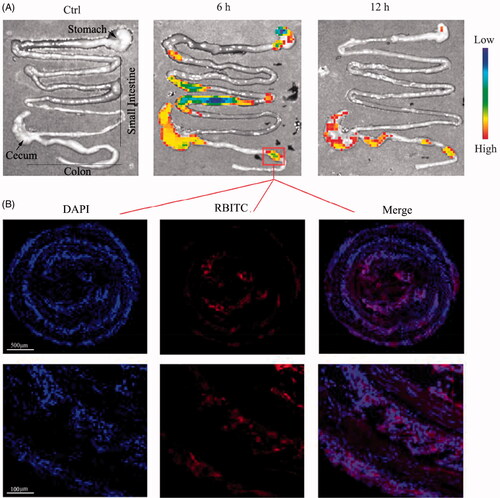 Figure 3. Biodistribution and accumulation of CD–Cur–CANPs in colitis mice. (A) The ex vivo inflorescence images were obtained to show the biodistribution of RBITC-embedded CD–Cur–CANPs after 6 h and 12 h administration. (B) Fluorescence microscopy images of colonic tissue slices at 6 h. Blue, DAPI for nuclear staining; red, RBITC-labeled nanoparticles.