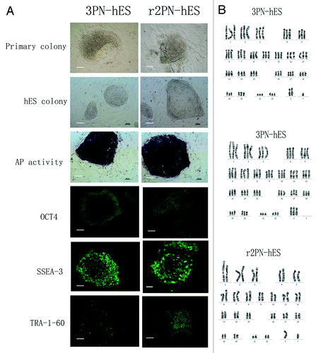 Figure 4. General characteristics of hES cells from 3PN and r2PN blastocysts. (A) The inner cell mass from the blastocyst could attach and form the primary colony, which then propagated by the mechanical method in both the 3PN and r2PN groups. The distinct cell colony boundary, high nuclear/cytoplasm ratio and tightly packed colonies could be observed, and these colonies showed positive AP activity. The ES cells positively expressed a pluripotency marker (OCT4) and ES cell surface markers (SSEA3 and TRA-1–60). (B) Triploid karyotyping (69, XXY and 69, XXX) was observed in 3PN-hES cells, and diploid karyotyping (46, XY) was observed in r2PN-hES cells.