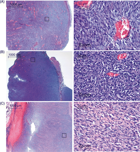 Figure 9. H&E staining after (A) tumour hyperthermia, (B) 1.5 h post tumour ablation and (C) 4 days post tumour ablation. The black box indicates the areas from which the high magnification images were taken.